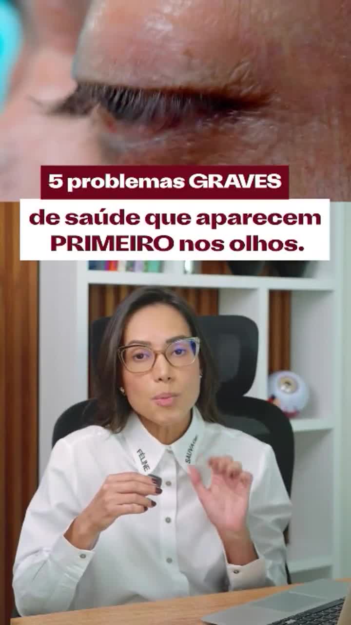 Reel sobre sinais nos olhos da Dra. Maria Vasques